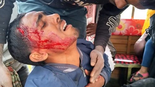 সুনামগঞ্জের দিরাইয়ের বদলপুর এলাকায় গাছের সাথে ধাক্কা লেগে সিএনজির চালকসহ ৫ জন আহত