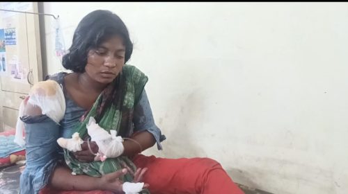 মোল্লাহাটে গৃহবধূকে কুপিয়ে জখমের অভিযোগ, স্বামী পলাতক